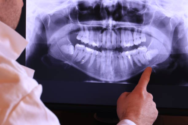 Best Emergency Dentist for Knocked-Out Tooth in Brooklyn Heights, OH